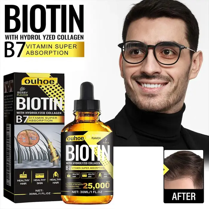 L'huile de croissance des cheveux infusée à la biotine prévient la perte