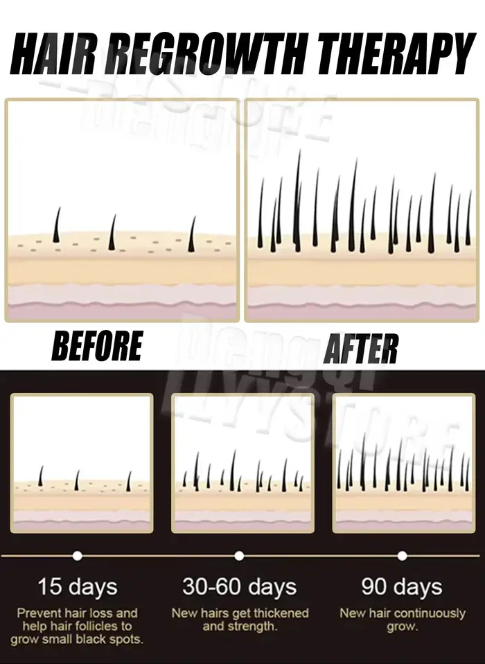 Sérum de croissance des cheveux