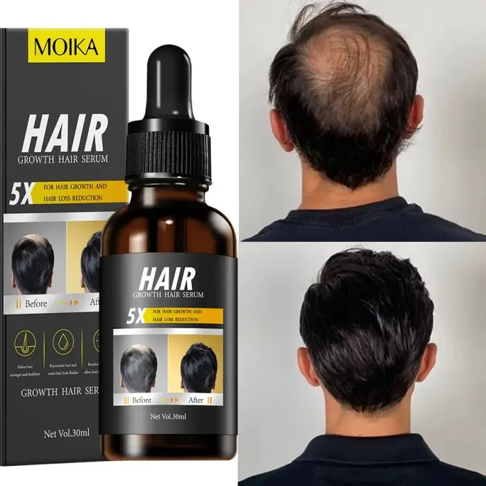 Sérum de croissance rapide des cheveux