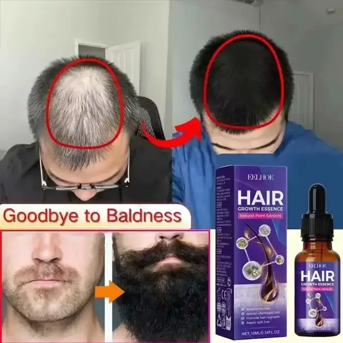 La croissance des cheveux