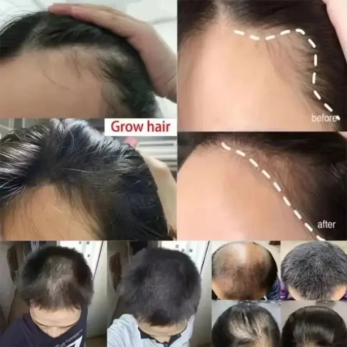 Sérum de croissance des cheveux 7 jours
