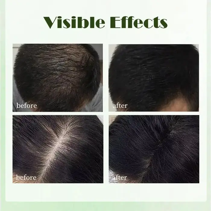 Barre de shampoing naturelle Usman + masque capillaire + ensemble d'huile