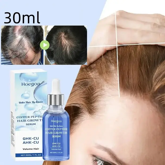 Sérum de croissance des cheveux, Anti-perte, huile de croissance des cheveux, prévient la calvitie, 