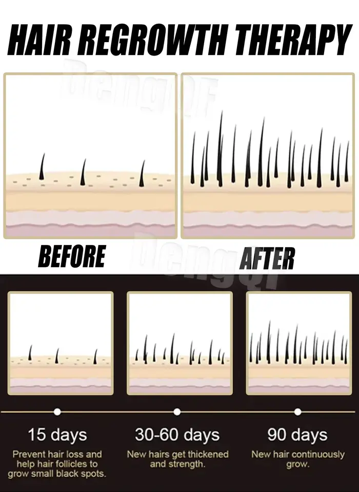 Anti-chute de cheveux favorise la croissance de vos cheveux