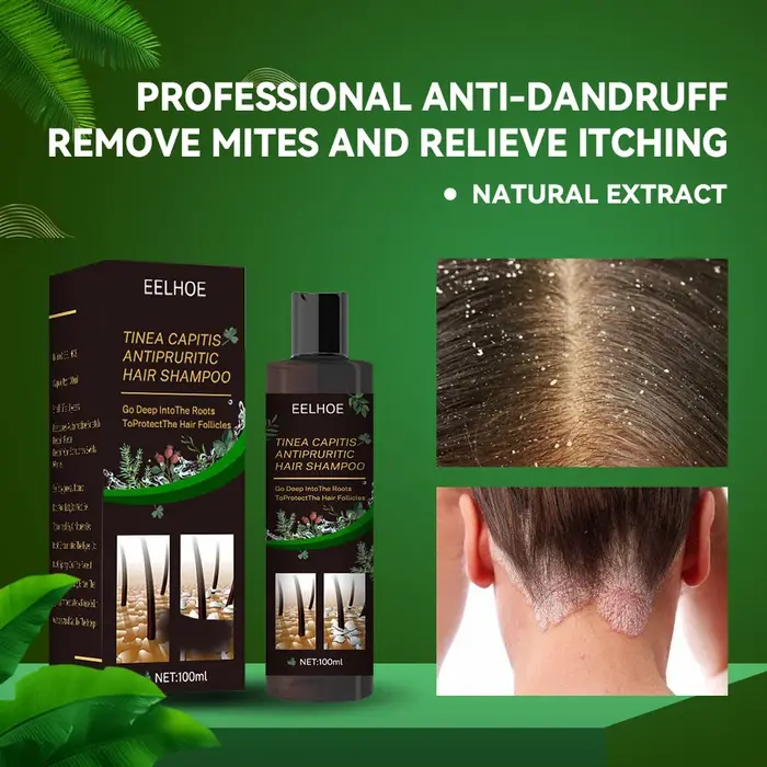 100ml Eelhoe shampooing Anti-démangeaisons