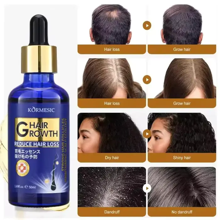 Sérum de croissance des cheveux