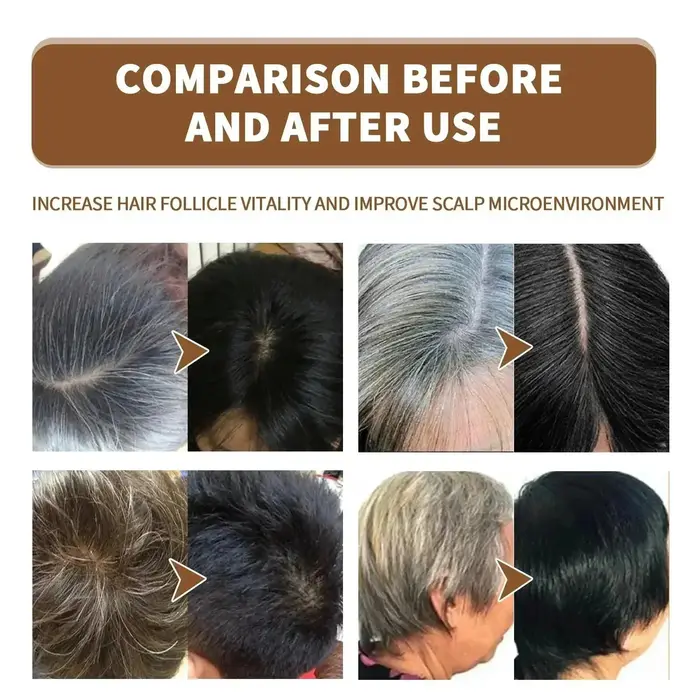 Prévenir le vieillissement des cheveux et traiter