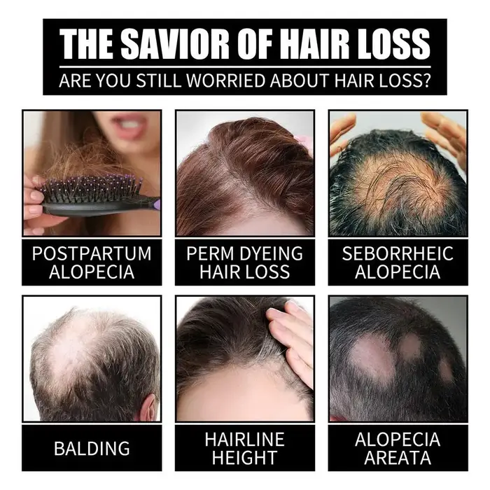 Sérum à l'huile de biotine pour la repousse rapide des cheveux