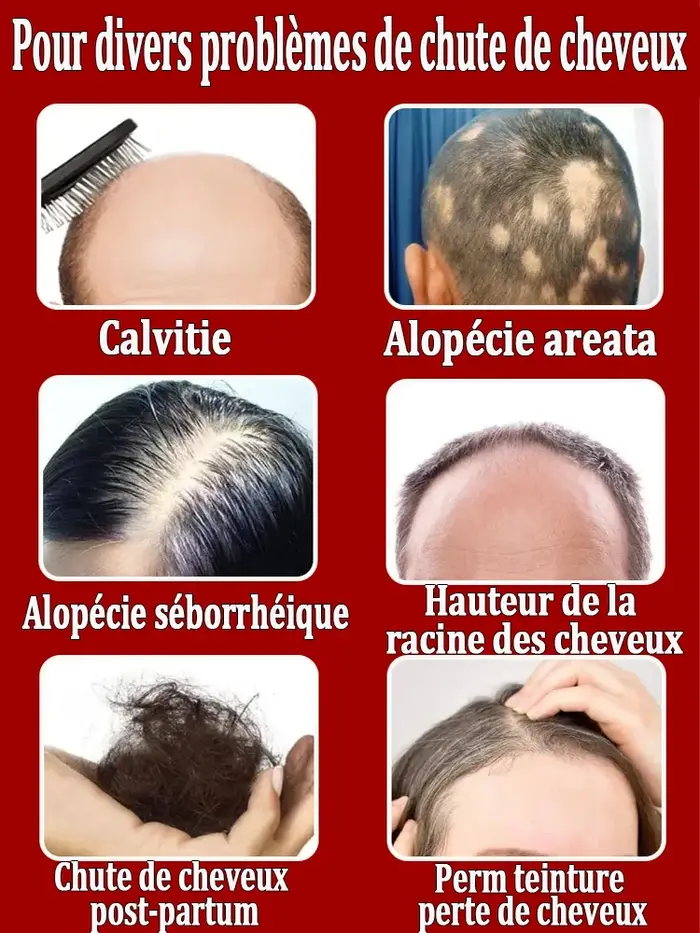 Le cuir chevelu était entièrement nourri