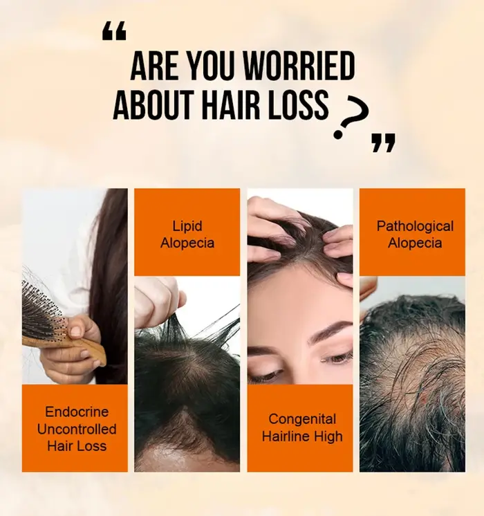 Produits de croissance des cheveux au gingembre huile essentielle