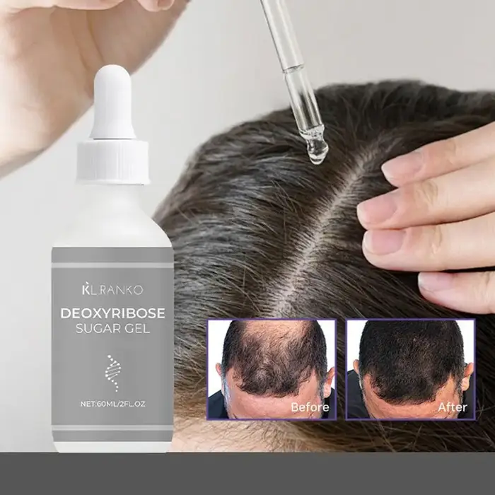 Deoxyribose gingembre extrait de feuille de cyprès huile essentielle nourrir et renforce en profondeur les cheveux soin
