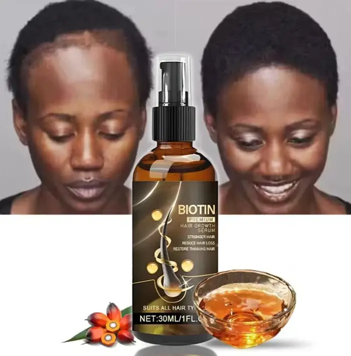 Sérum anti-chute de cheveux