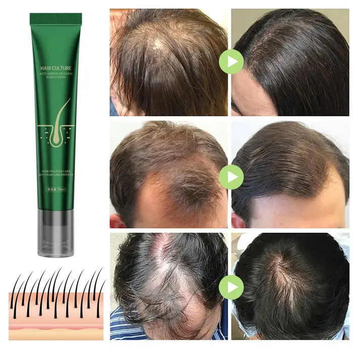 Huile essentielle de soin capillaire au gingembre naturel