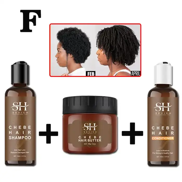 Sevich Chebe traitement de perte de cheveux Spray Traction Alopecia