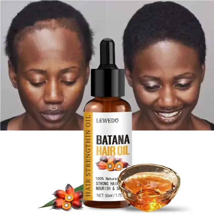 Lewedo Naturals huile de Batana croissance rapide des cheveux pour hommes femmes