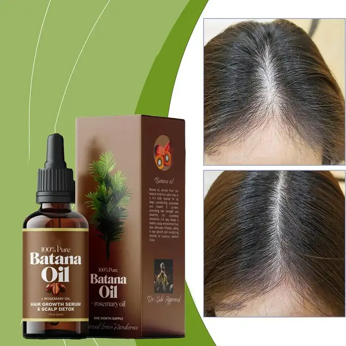 Huile de Batana 100% pure + sérum de croissance capillaire à la romarin 30ml