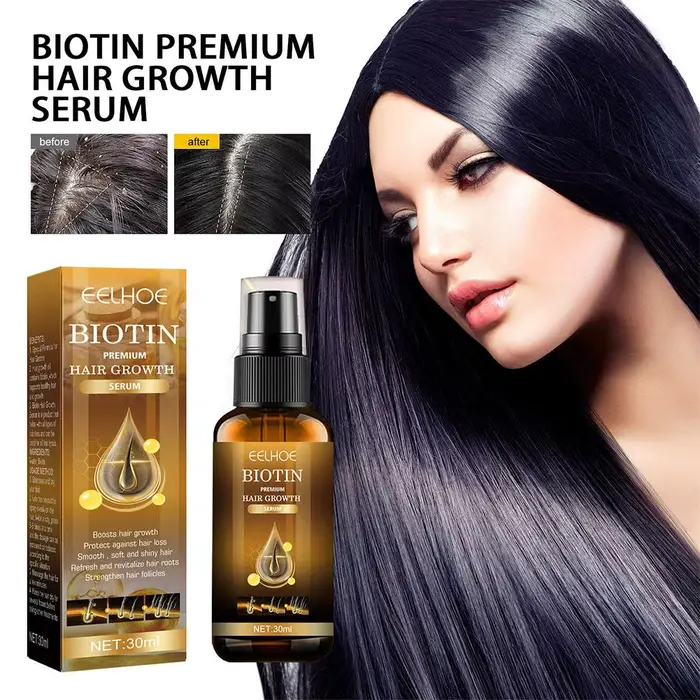 Produits biotine épaississement croissance rapide soins capillaires huiles essentielles Anti perte de cheveux Spray traitement du cuir chevelu pour hommes femmes