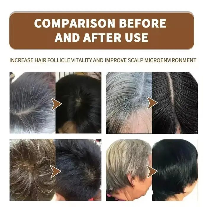 Sérum de traitement pour cheveux gris et blancs