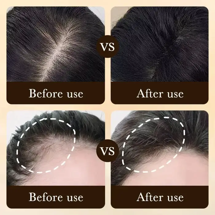 Huile de croissance rapide des cheveux à la biotine pour hommes