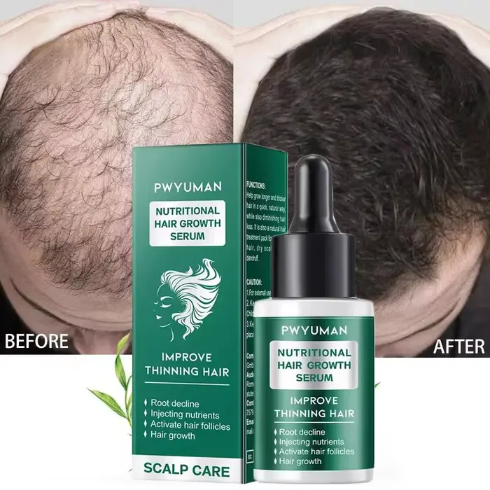 Sérum de croissance rapide des cheveux pour femmes et hommes