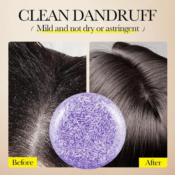 Shampooing Solide à la Lavande Anti-Pelliculaire et Contrôle du Sébum pour Cheveux Secs et Abîmés, Soin du Cuir Chevelu