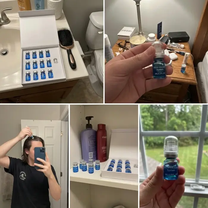 Kit de repousse des cheveux par micro-aiguilles