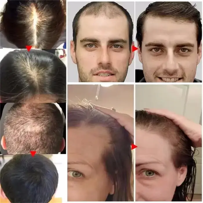 Sérum de croissance rapide des cheveux
