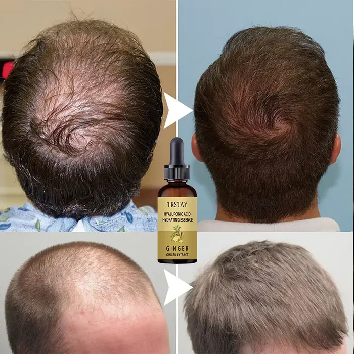 Sérum de croissance des cheveux