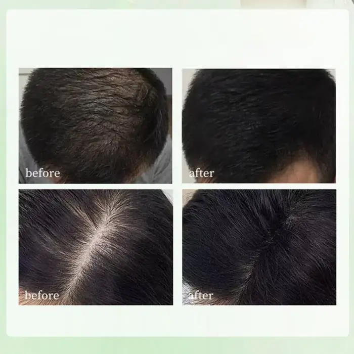 Shampoing à base de plantes naturelles