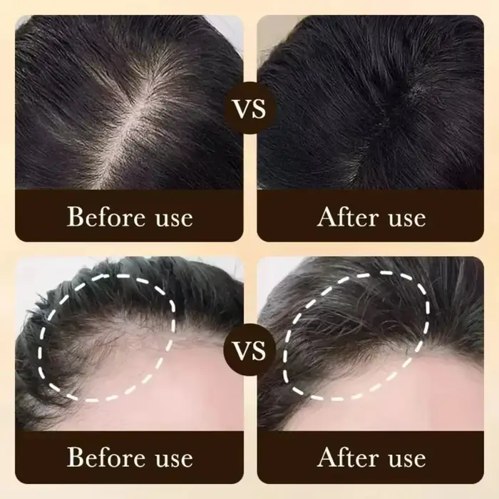 Essence de croissance et d'épaississement des cheveux