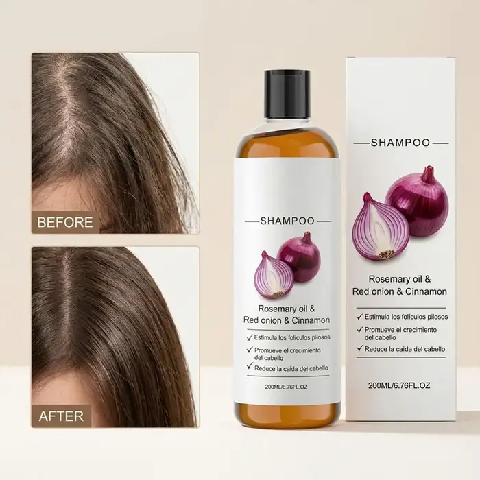 Shampoo à l'huile de romarin et d'oignon rouge anti-chute de cheveux