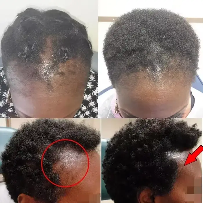 Kit de Croissance Capillaire Rapide : Huile de Batana