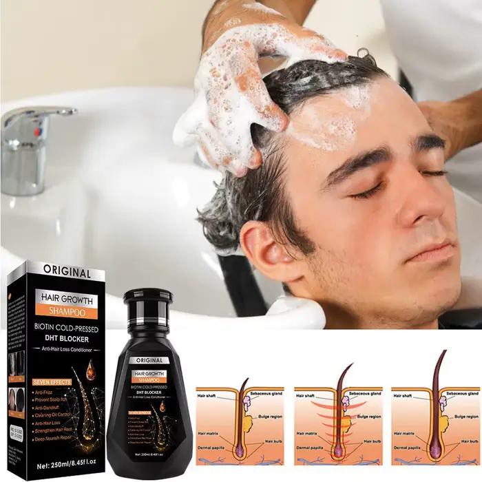 Shampoing à la biotine avec peigne, brosse pour la croissance des cheveux, Anti-pelliculaire, soulage les démangeaisons, renforcer le traitement contre la perte de cheveux, pour femmes et hommes, 250M