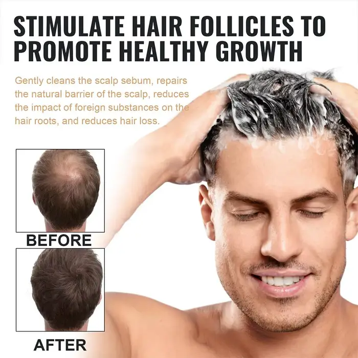 Eelhoe shampooing activateur de racines naturelles Anti-chute de cheveux soin