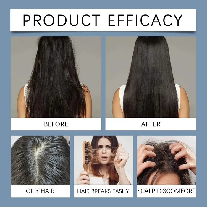 Sérum Capillaire Croissance au Romarin en Roll-On – Traitement du Cuir Chevelu Anti-Chute et Épaississant – Nourrit et Renforce les Racines des Cheveux