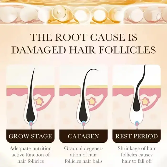 Essence de croissance et d'épaississement des cheveux