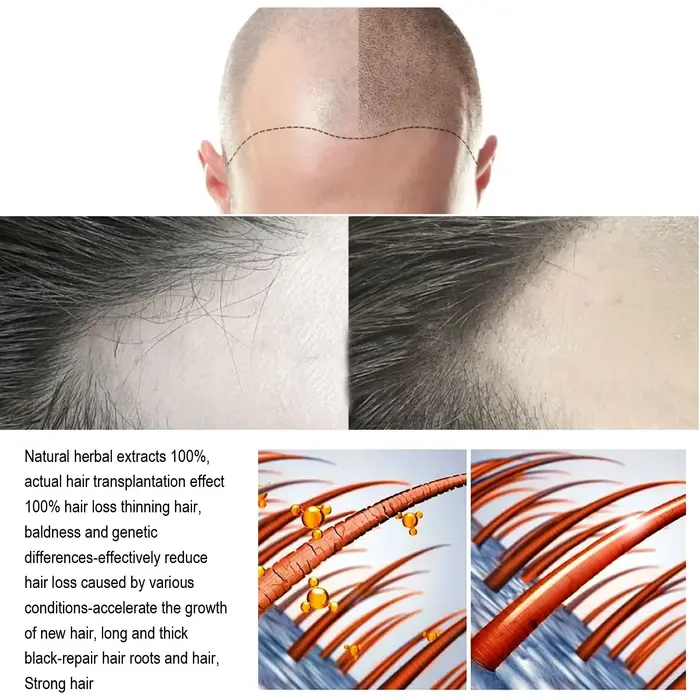Huile essentielle de soin capillaire au gingembre naturel