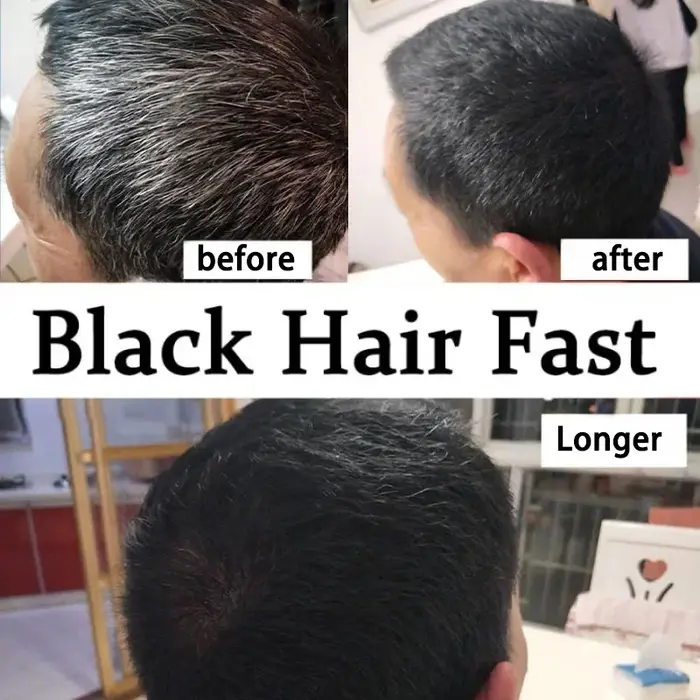 Prévenir le vieillissement des cheveux et traiter