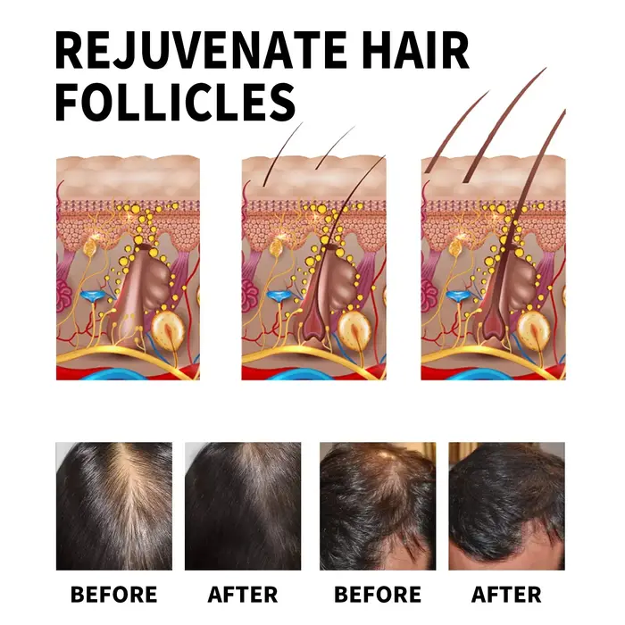 Produits de croissance des cheveux au gingembre huile essentielle