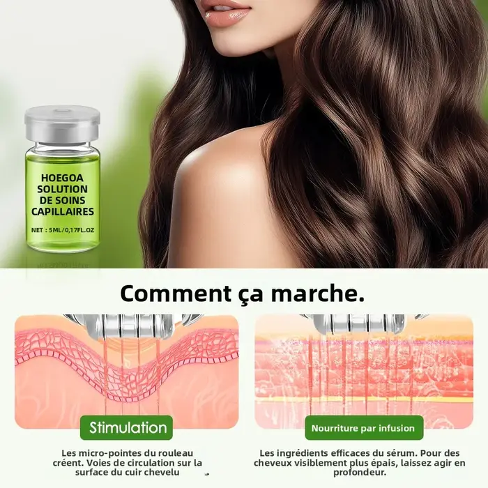 Système de repousse des cheveux