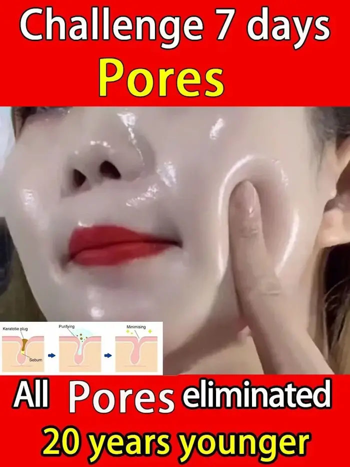 Skin Bergamo | Pore Refining Resurfacing