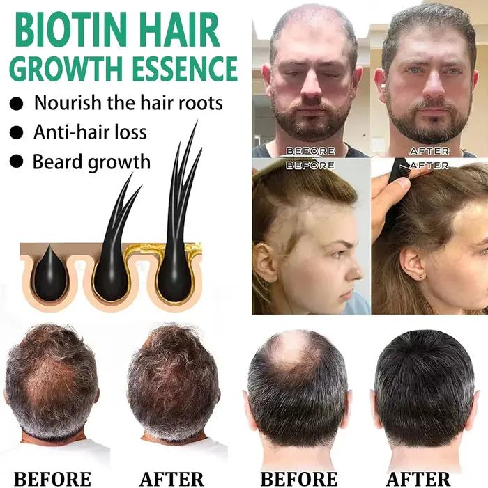 Sérum de croissance rapide des cheveux