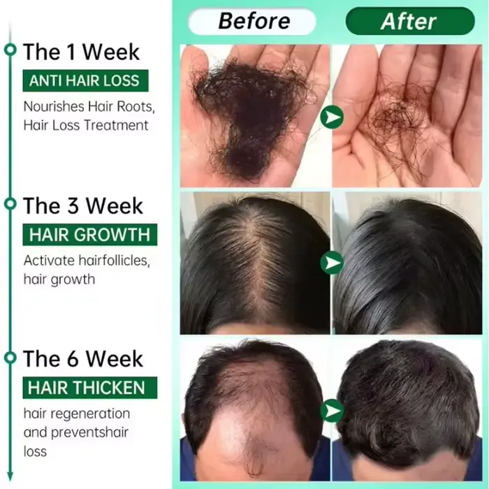 Sérum de croissance des cheveux au gingembre