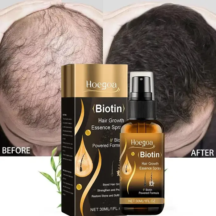 Spray de croissance rapide des cheveux à la biotine
