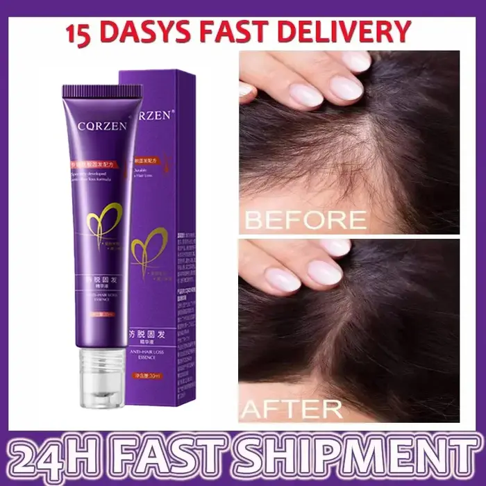 Sérum de croissance des cheveux 7 jours, Capsule essentielle de repousse rapide, Anti-perte de cheve