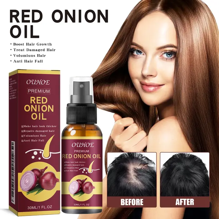 Huile essentielle pour la croissance des cheveux à l'oignon rouge