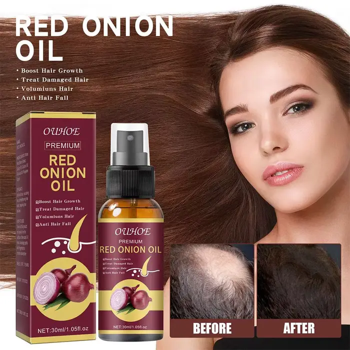Spray d'huile essentielle d'oignon rouge pour soins capillaires