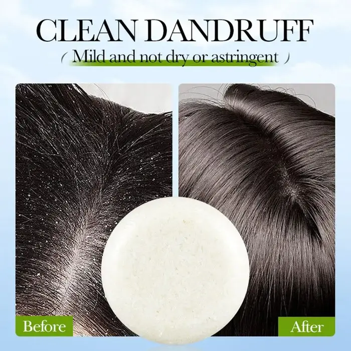 Savon Solide au Romarin pour Cheveux – Contrôle du Sébum