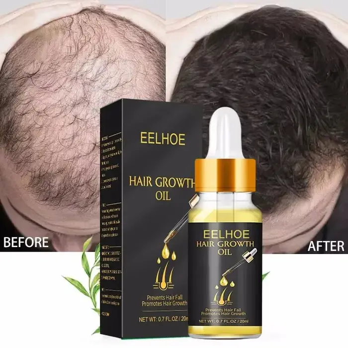 Sérum de croissance rapide des cheveux, huile essentielle Anti-chute, réparation du cuir chevelu end