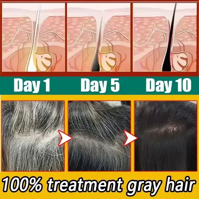 Sérum de traitement capillaire Anti-gris à base de plantes